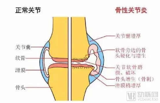 聚乙烯材料什么是聚乙烯材料？的最新报道(图4)